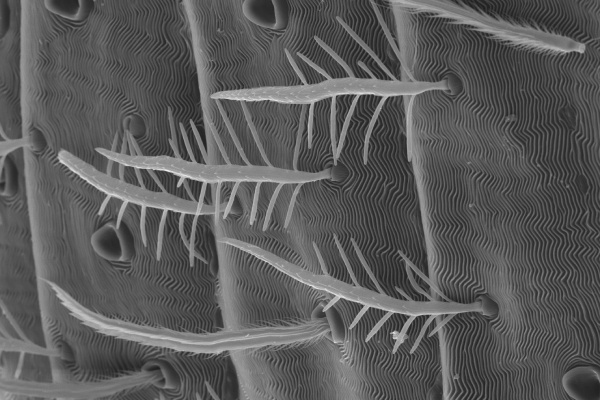 gray and white microscopic image