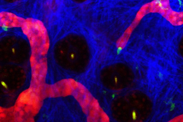 blue and red microscope image