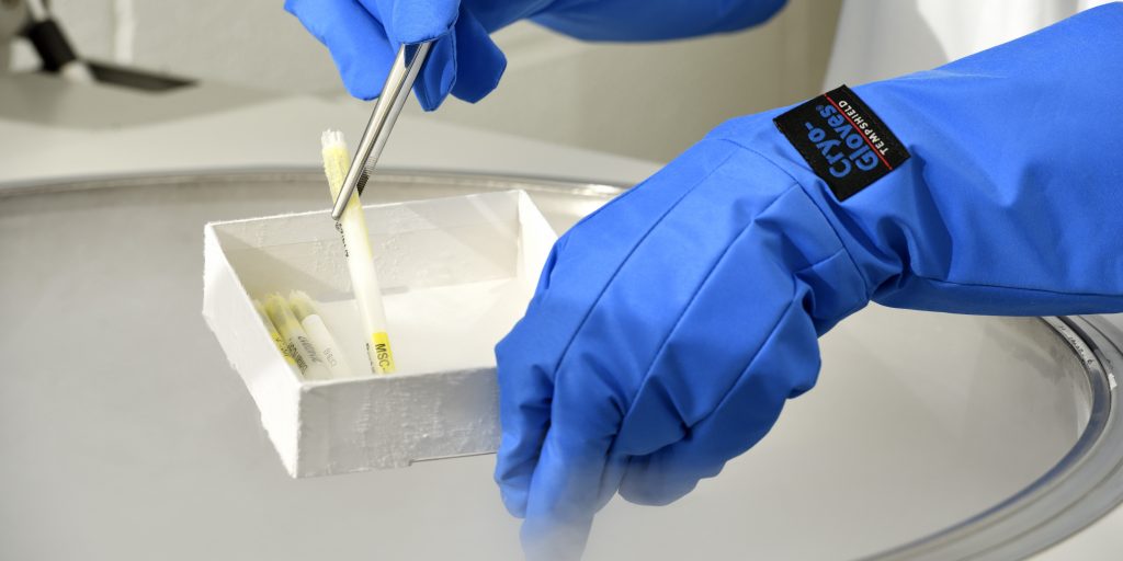 Gloves hands remove samples from cryo freezer